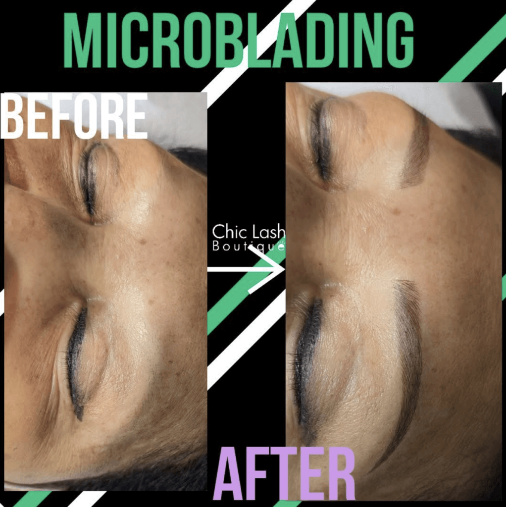 Microblading for Alopecia Patients - Is it Advised?