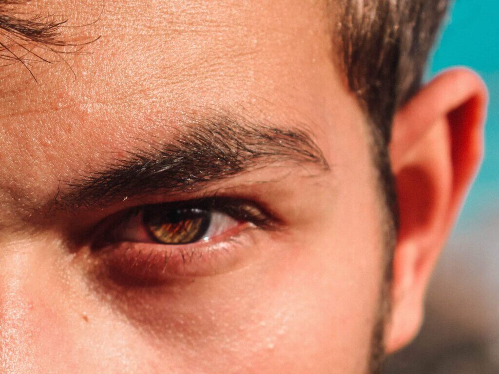 I’ve Got Crusty, Flaky Eyebrows… But Still Want Microblading!